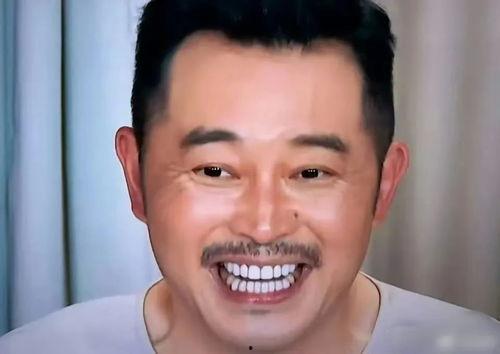 明星有假牙,美丽背后的秘密武器